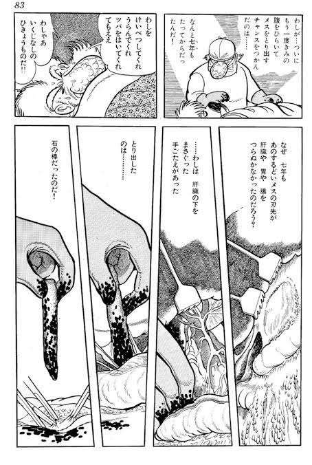 体内に手術で使用のビニール袋を置き忘れ 手術から約1か月後に腹部痛みで発覚