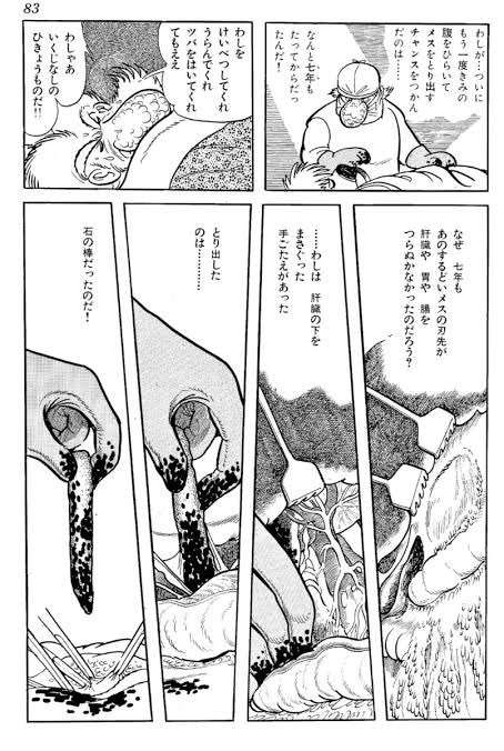 体内に手術で使用のビニール袋を置き忘れ 手術から約1か月後に腹部痛みで発覚
