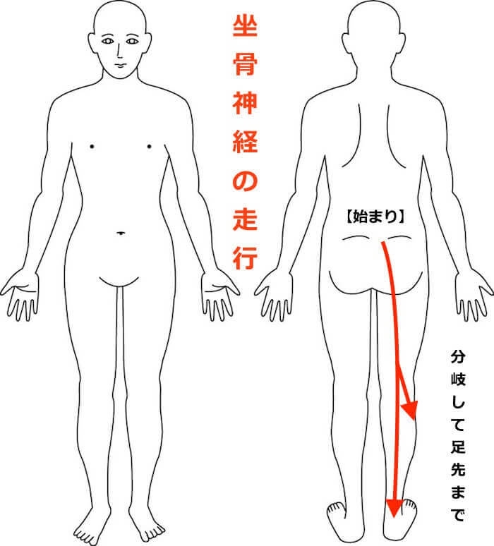妊婦さんで坐骨神経痛になった方