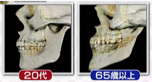 【40代～】結局整形や美容医療に頼らないと大きな変化は無いですよね？