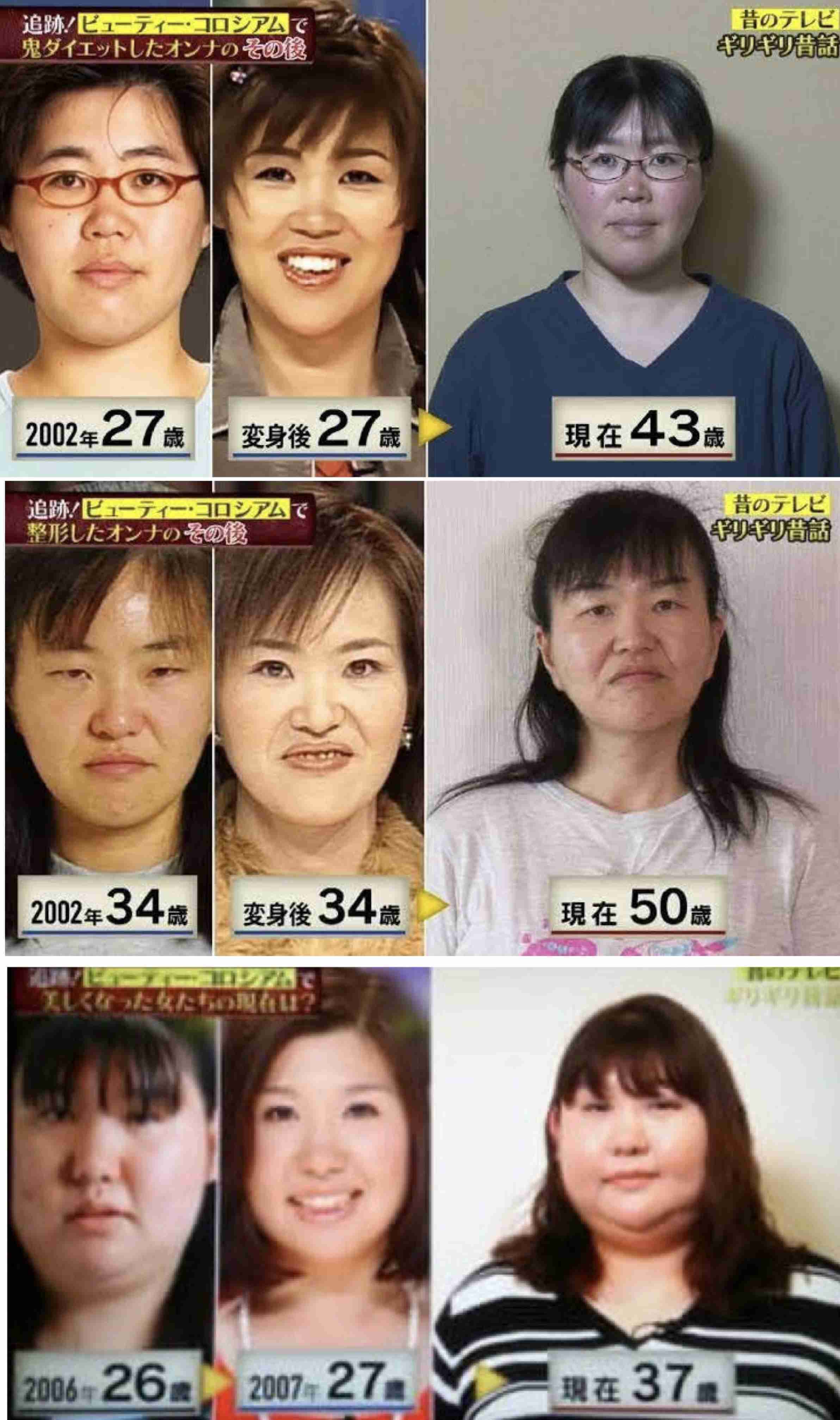 【40代～】結局整形や美容医療に頼らないと大きな変化は無いですよね？