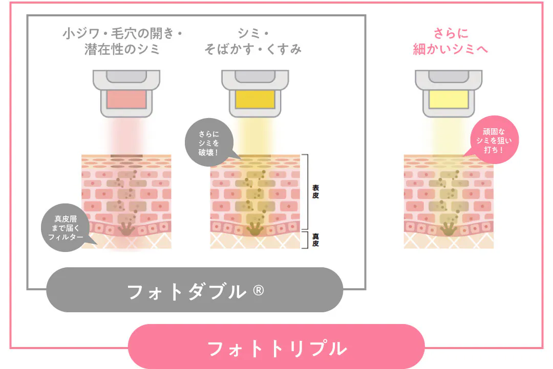 【40代～】結局整形や美容医療に頼らないと大きな変化は無いですよね？