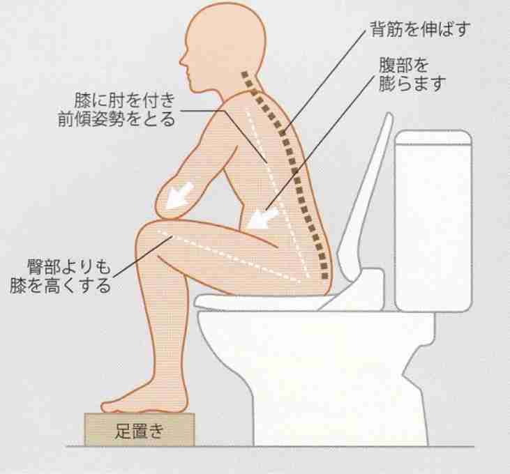 【助けて】便が出ない【明日検便】