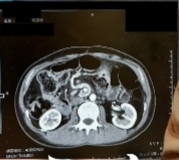 散財癖を直すには？