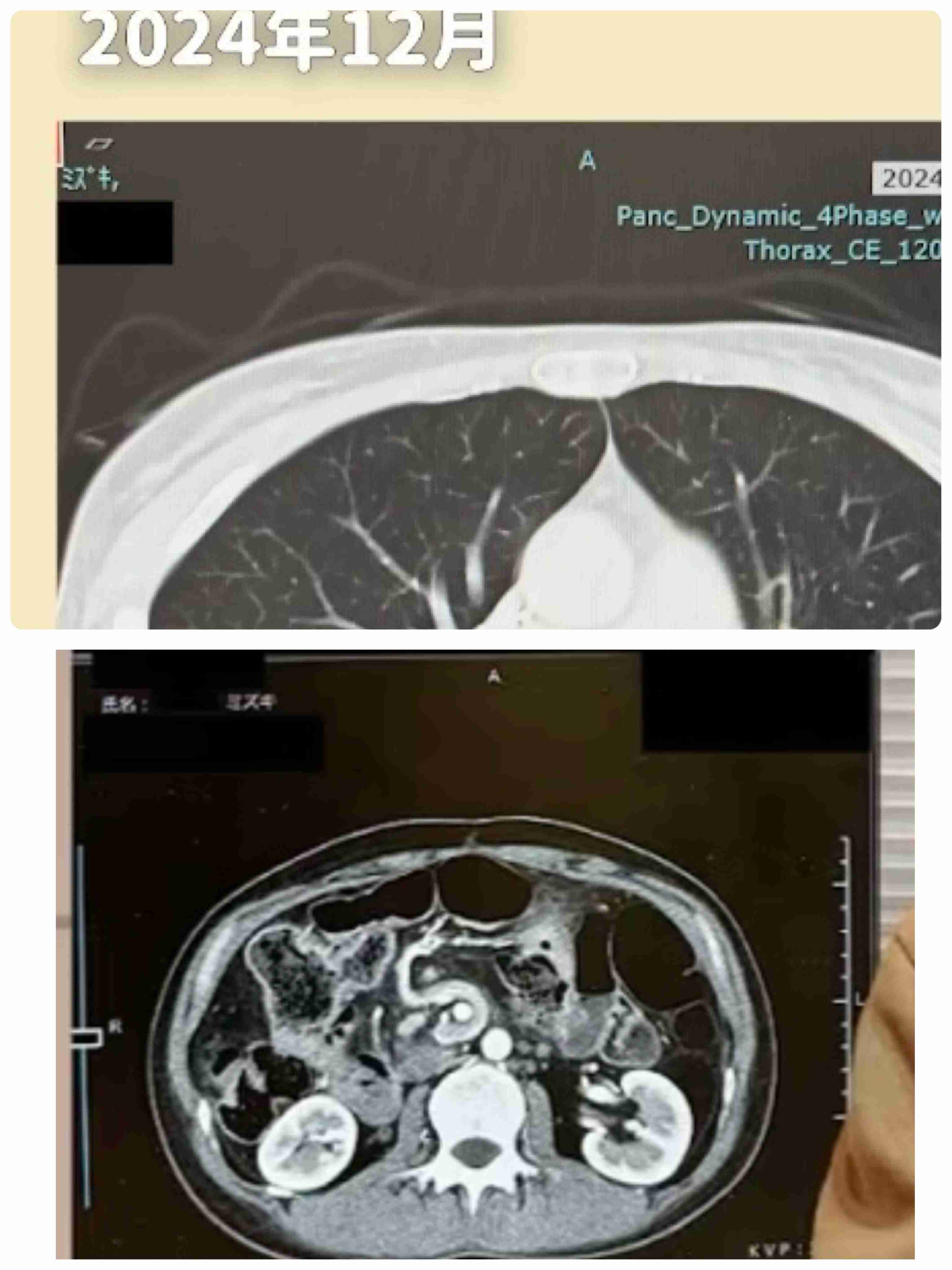 散財癖を直すには？