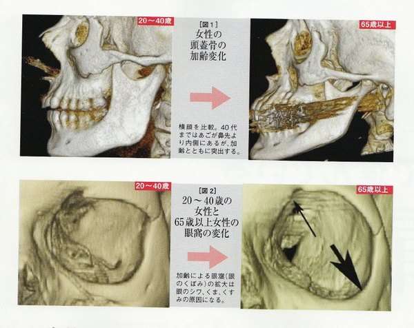 老化で顔が伸びたなって人