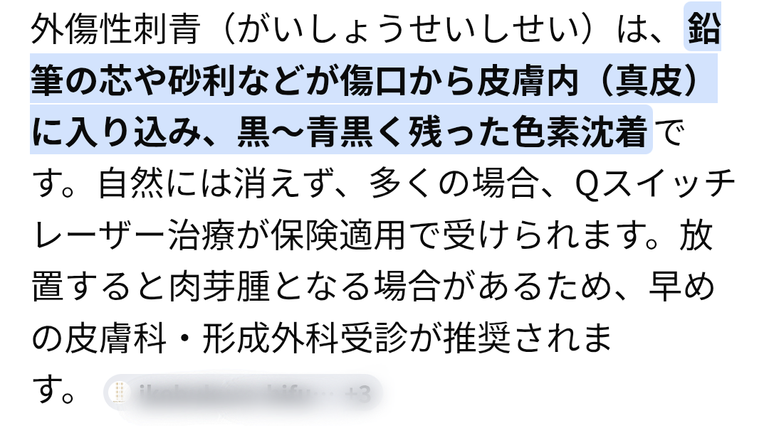 鉛筆の芯が刺さった人part2