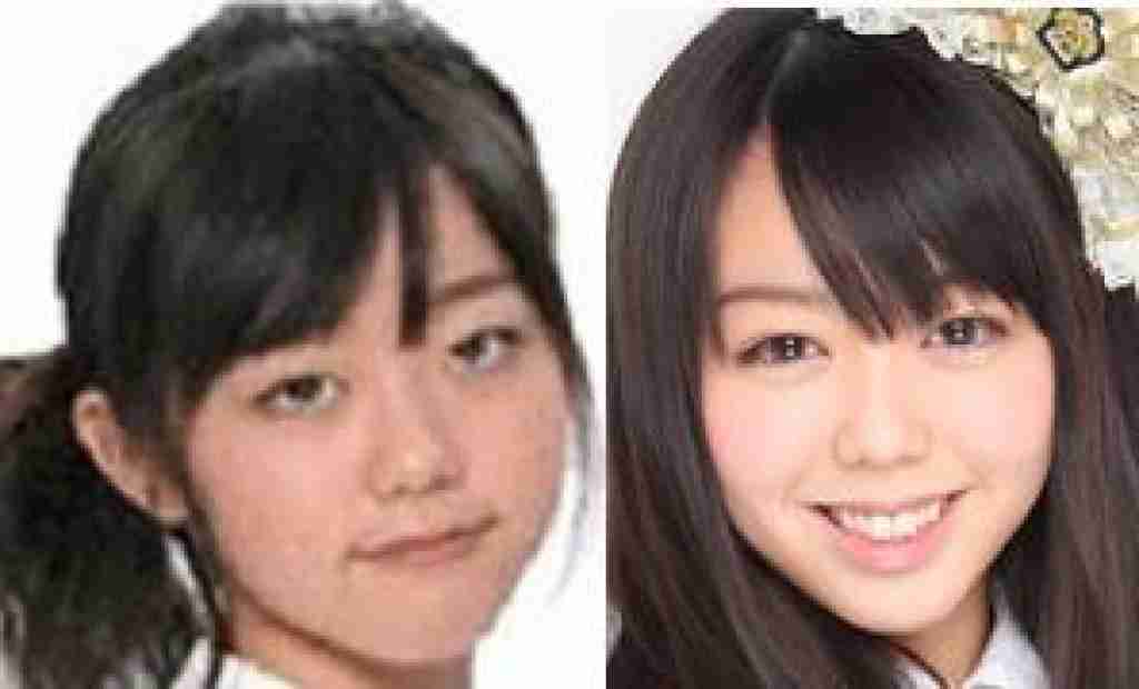 峯岸みなみ、夫・東海オンエアてつやの美容整形”を告白「こんなに変わるんだ」38万円のビフォーアフターが話題