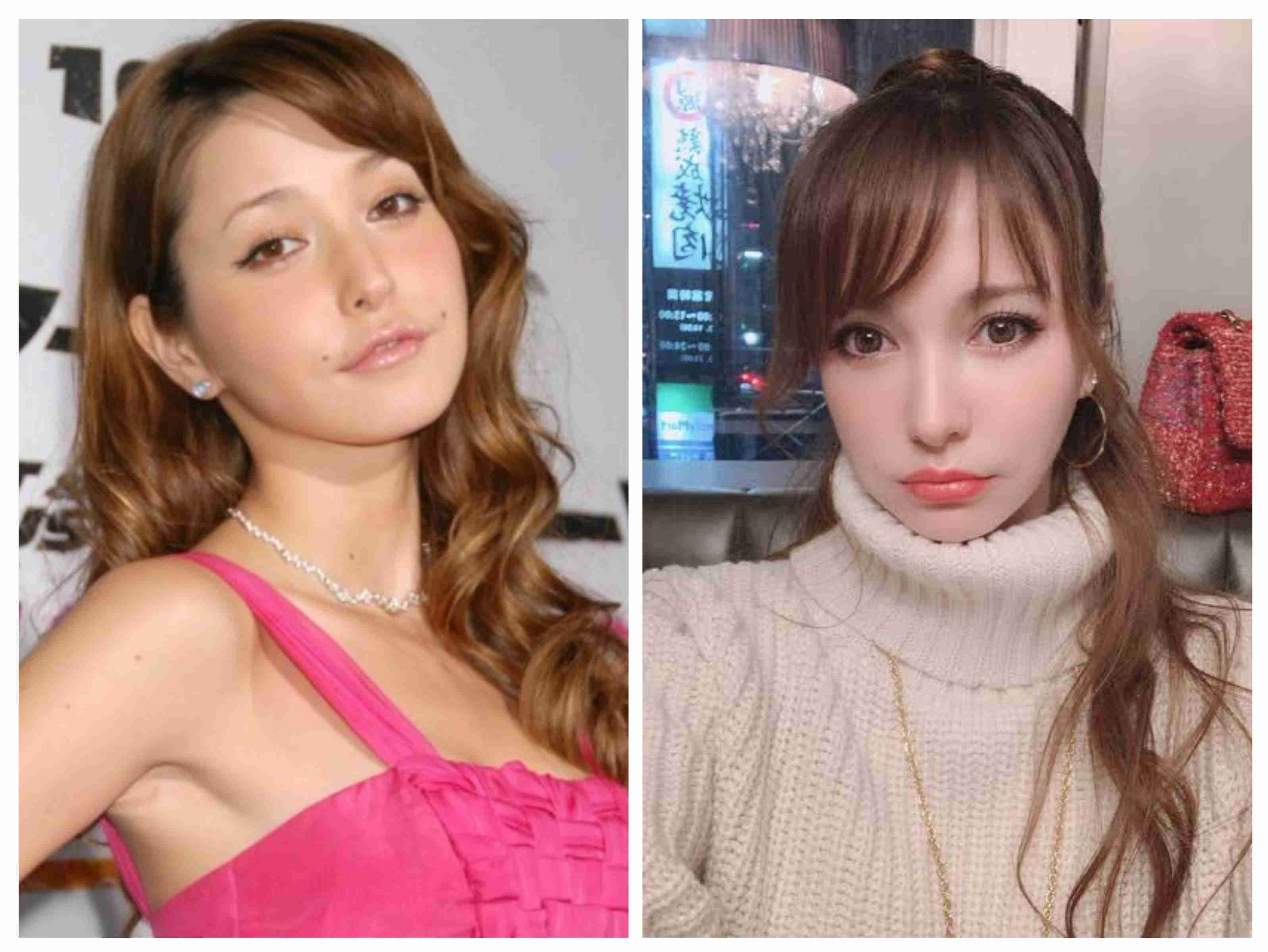 ほくろの除去【施術】