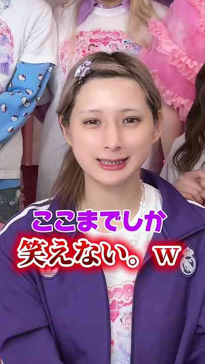 しなこ、両顎の骨切り手術を報告・術後の姿公開「10年くらい前に気づいてからずっとコンプレックスだった」顎変形症で5年前から矯正