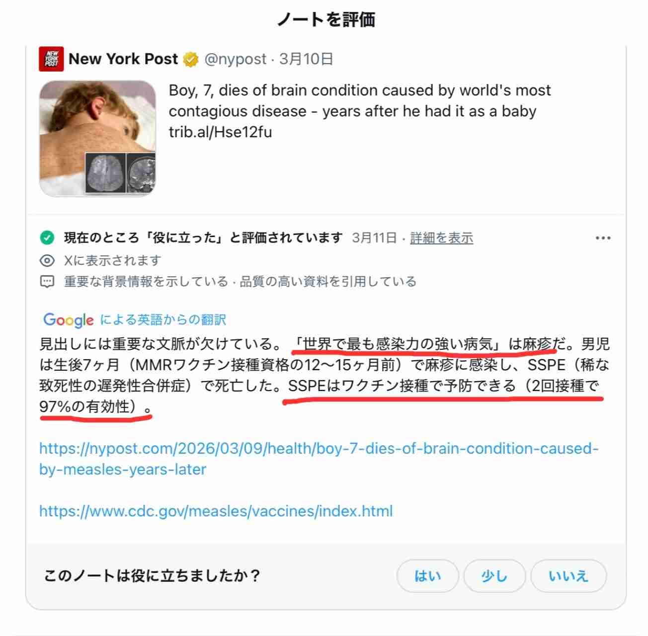 はしか感染者、都内で新たに15人確認…ハローワーク渋谷で不特定多数と接触した可能性も