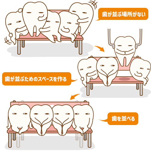 【助けて】横顔がブス【正面もブス】