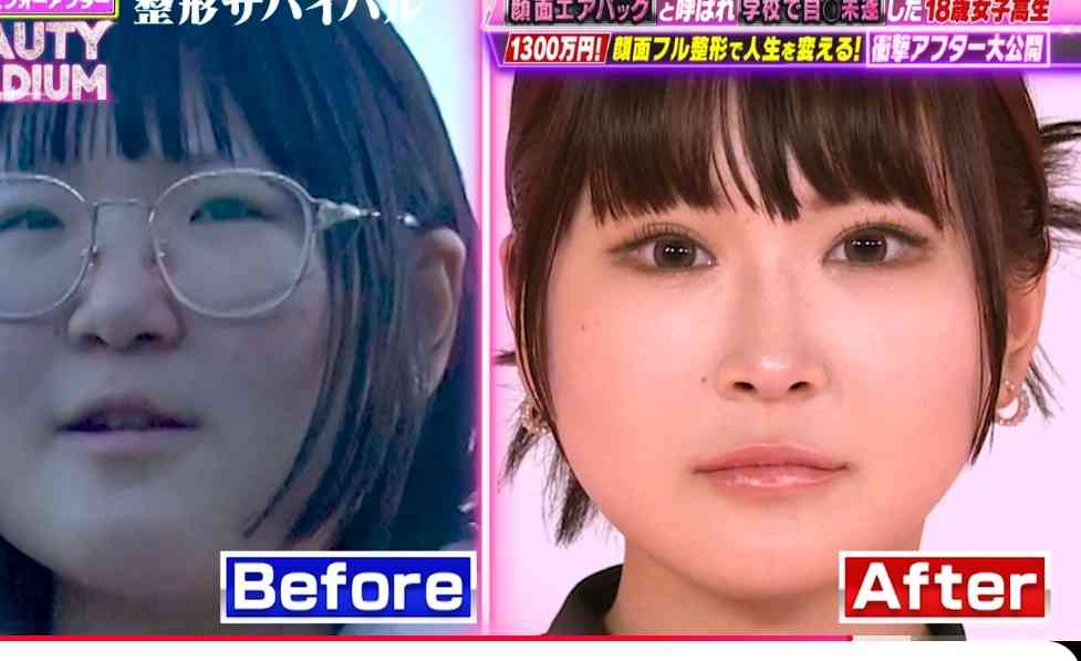 京大医学部受験のために撮った証明写真 →その1年後の姿に「美人過ぎる」「尊敬しかないです!」「これは嫉妬されるわ」