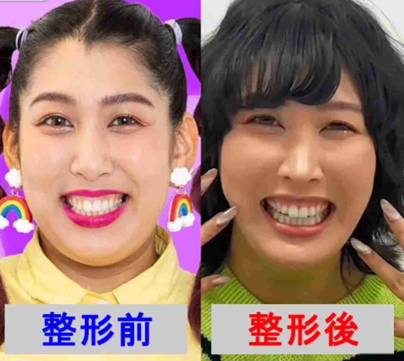 整形話題 3時のヒロイン・ゆめっちが“ありのまま”を公開「太くても丸くてもわたし」 ファン「おなかいいな」
