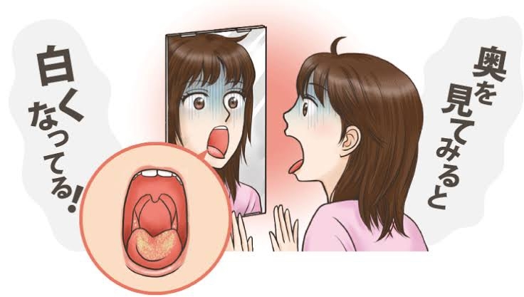 膿栓(臭い玉)