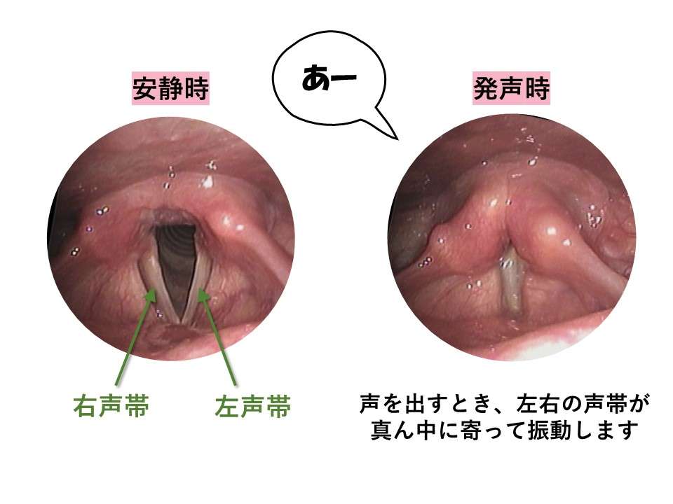 【アダルト注意】何となくエロいものをあげるトピPart6