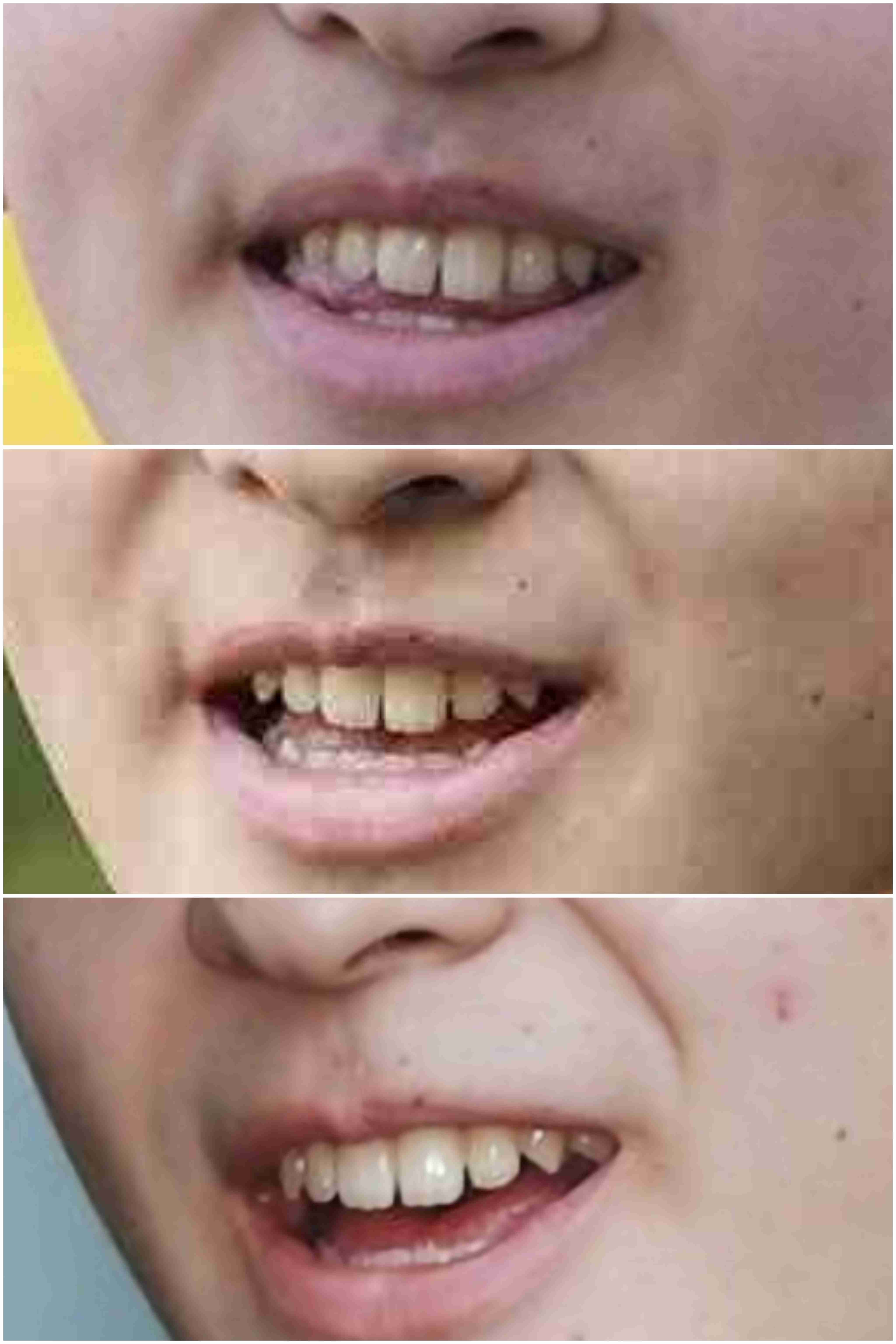 結婚後の婚約指輪