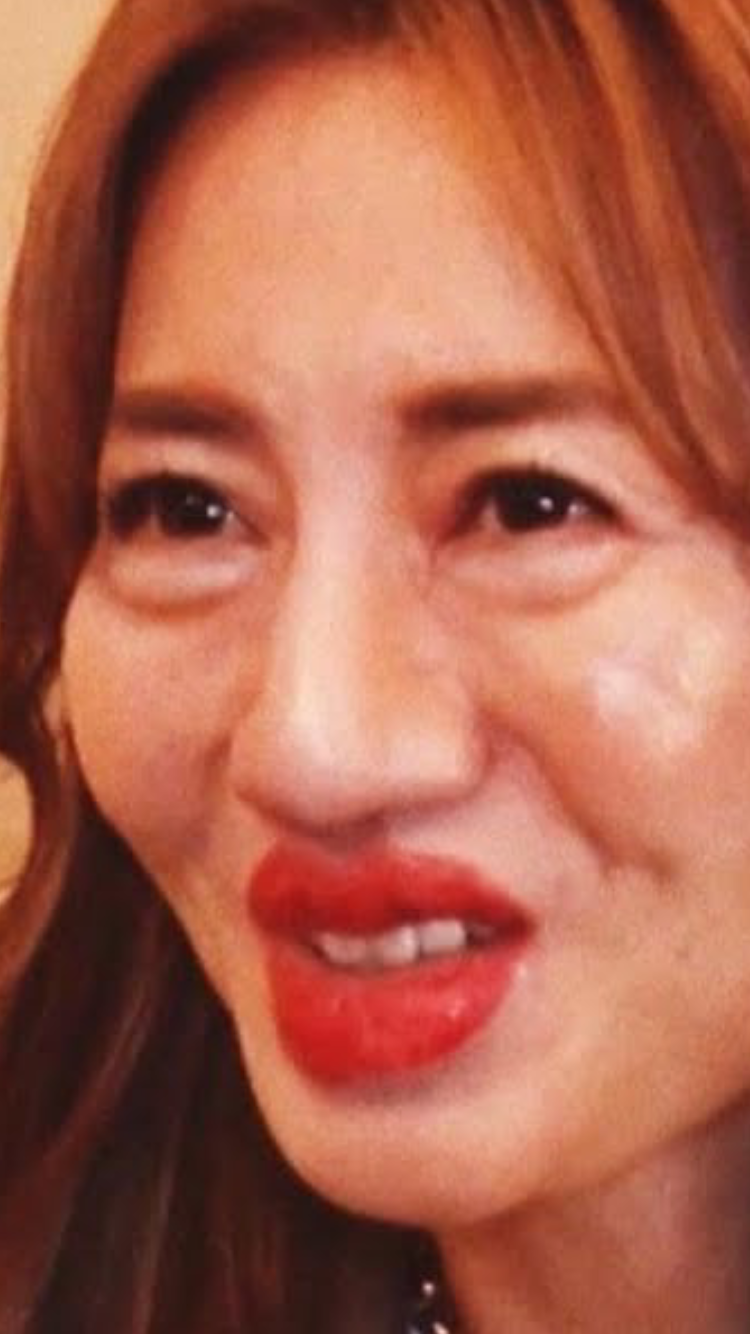 【急増】「人生やり直すなら“直美”が良い」何もできなくても年収2500万円？“直接”美容医療に進む若手医師は10年で10倍に…やりがいに頼る医療現場の現実と矛盾