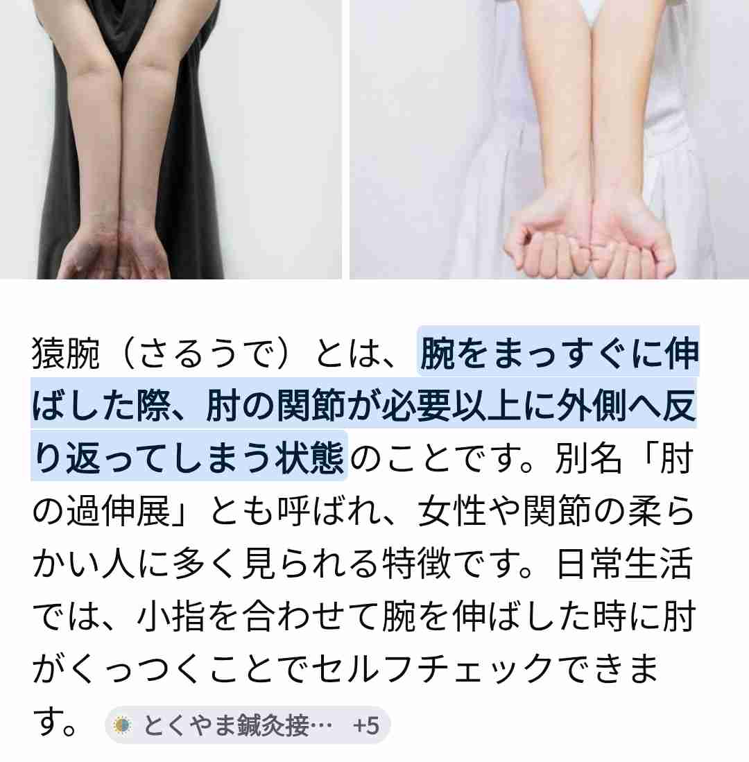 関節がゆるい、体が柔らかすぎる人