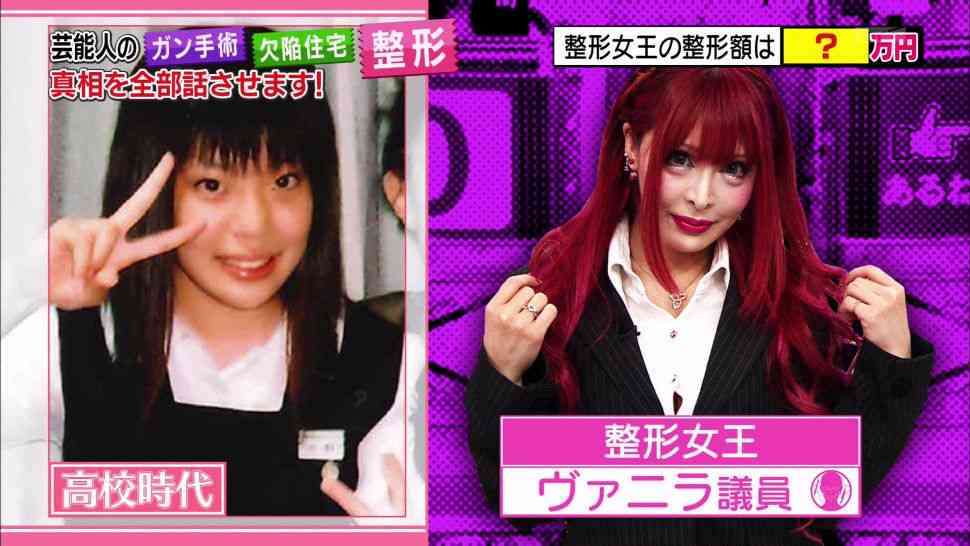 整形の疑問