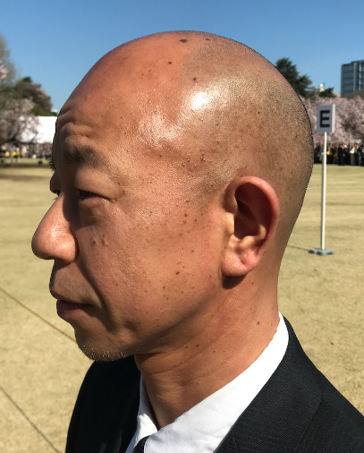 頭の形