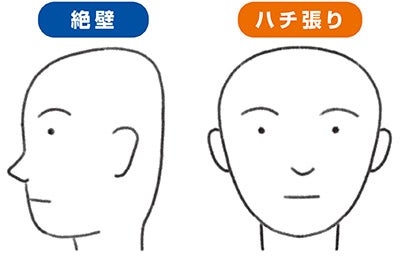 頭の形