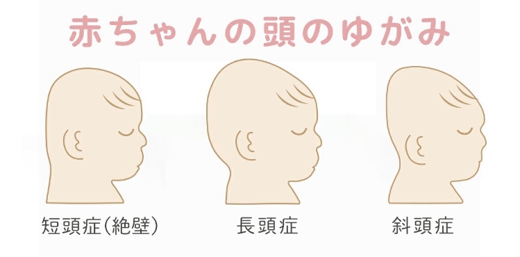頭の形