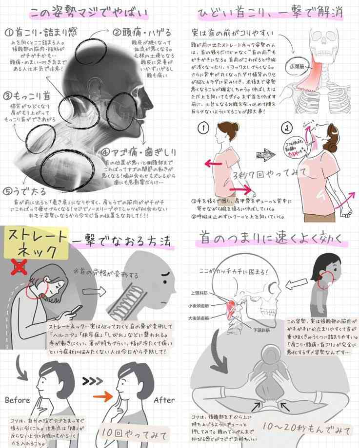ストレートネックの人