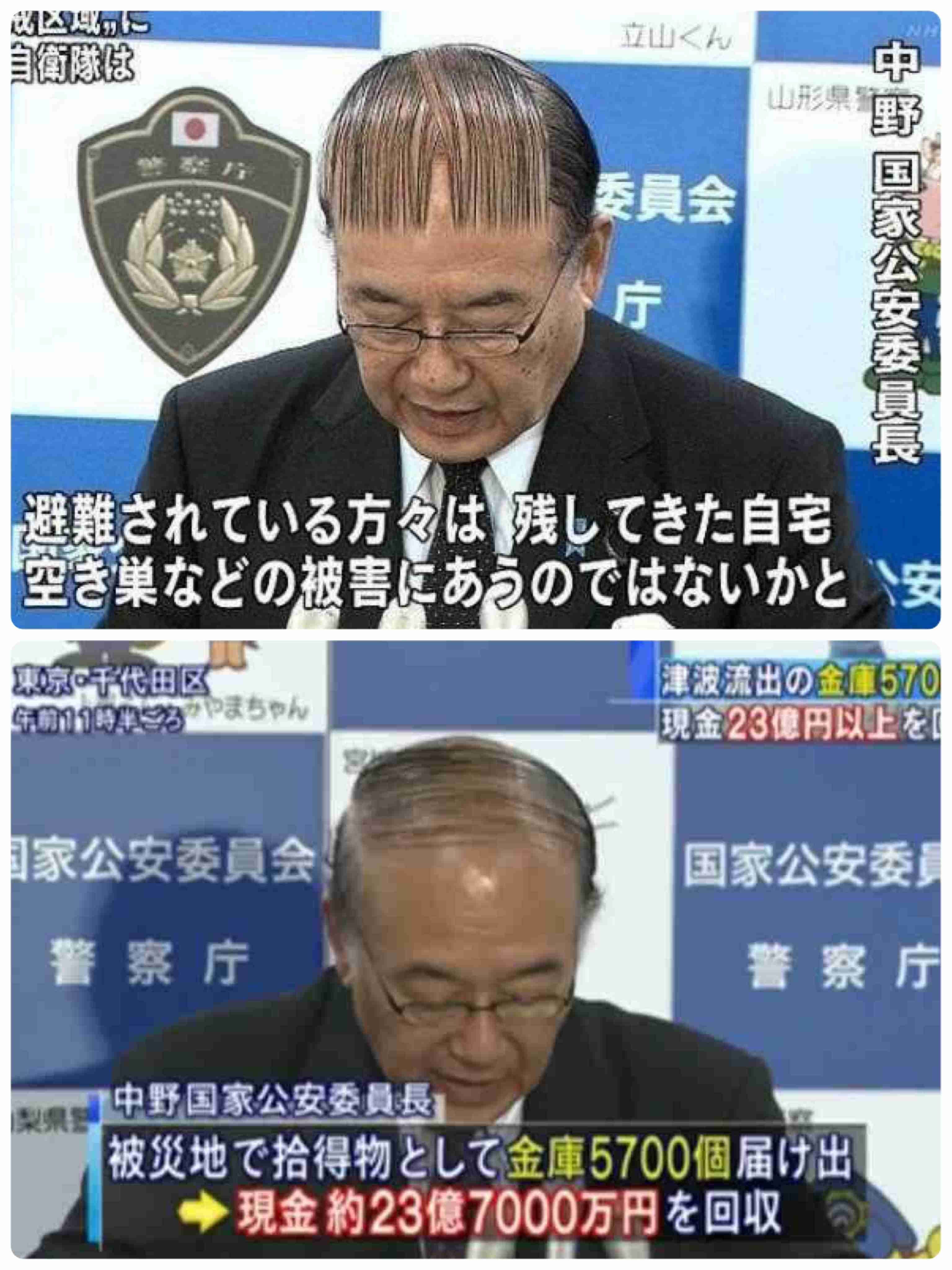 髪の生えグセ何とかしたい