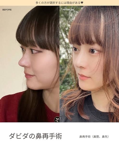 美容医療でやって後悔したもの