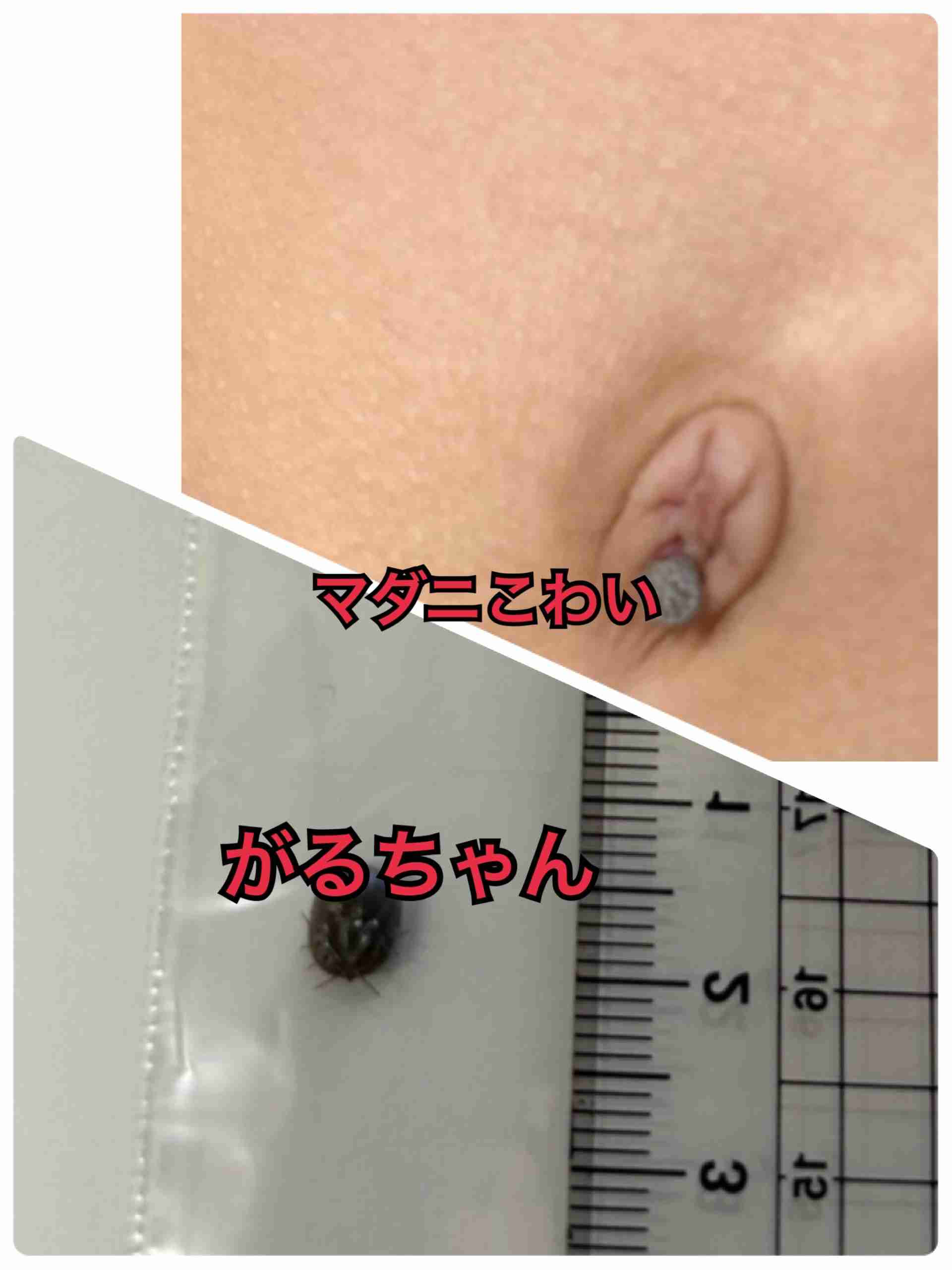 マダニ