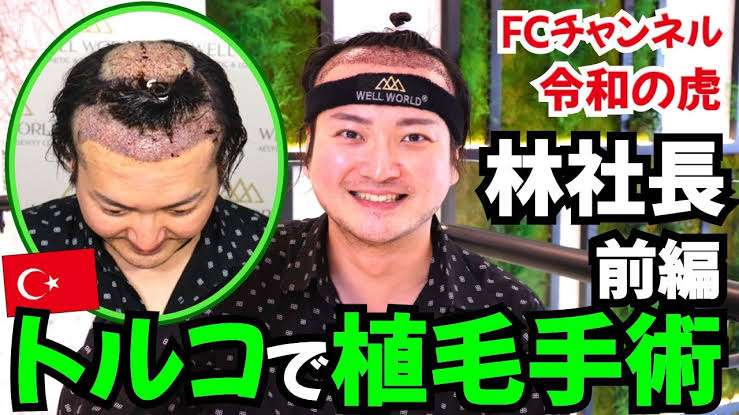 『令和の虎』林社長が“無意識泥酔”のなかキャバ嬢が追加注文→会計600万円が物議　法的問題を弁護士解説