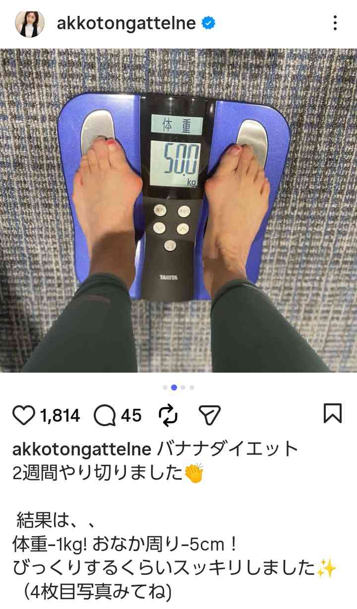 松本明子、自宅前で転倒→骨折 1ヶ月入院で「しばらくの間休業」、足以外のけがはなし