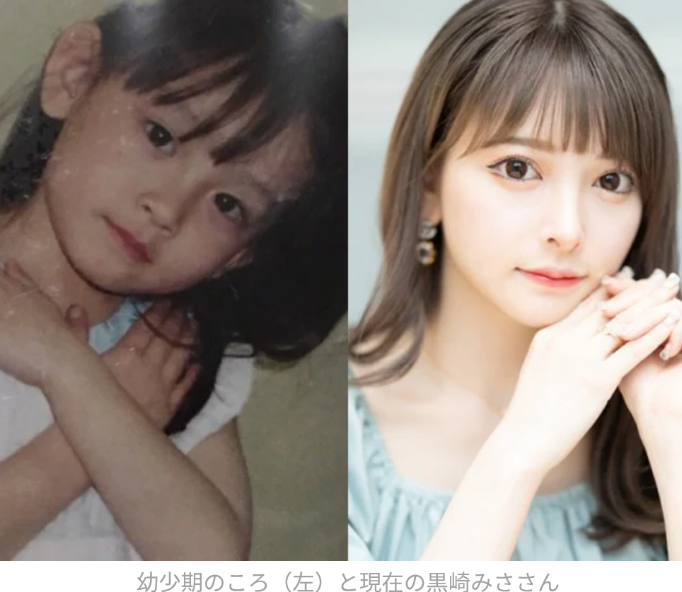 “整形総額2000万超え”黒崎みさ、離婚発表 双子の息子との3ショットで報告
