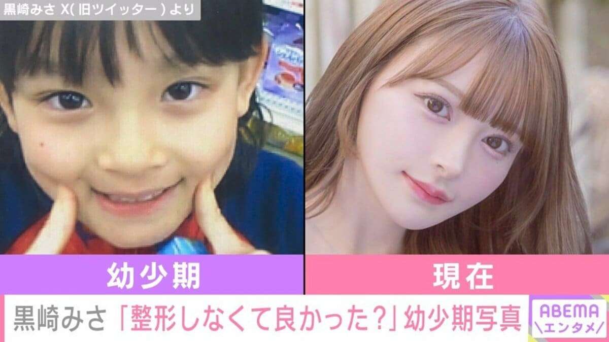 “整形総額2000万超え”黒崎みさ、離婚発表 双子の息子との3ショットで報告