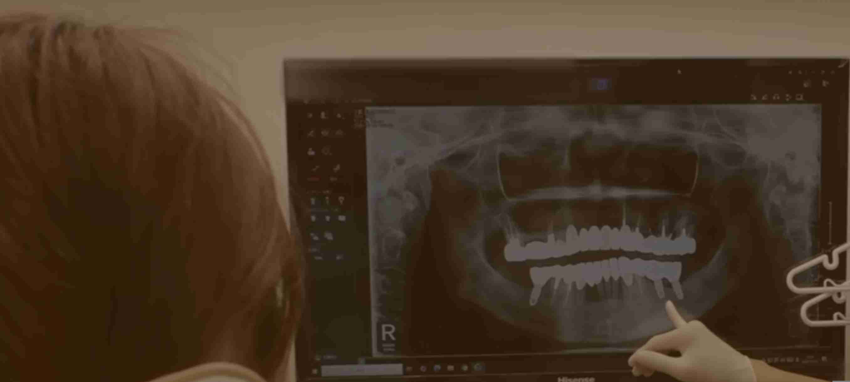 歯磨きキャンセル界隈