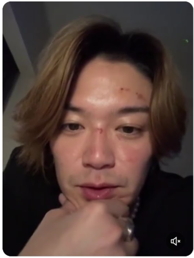 《新木優子と結婚のウラで…》中島裕翔（32）からtimeleszメンバーに「ドラマ主演が交代する」珍事が発生…いったいなぜ？