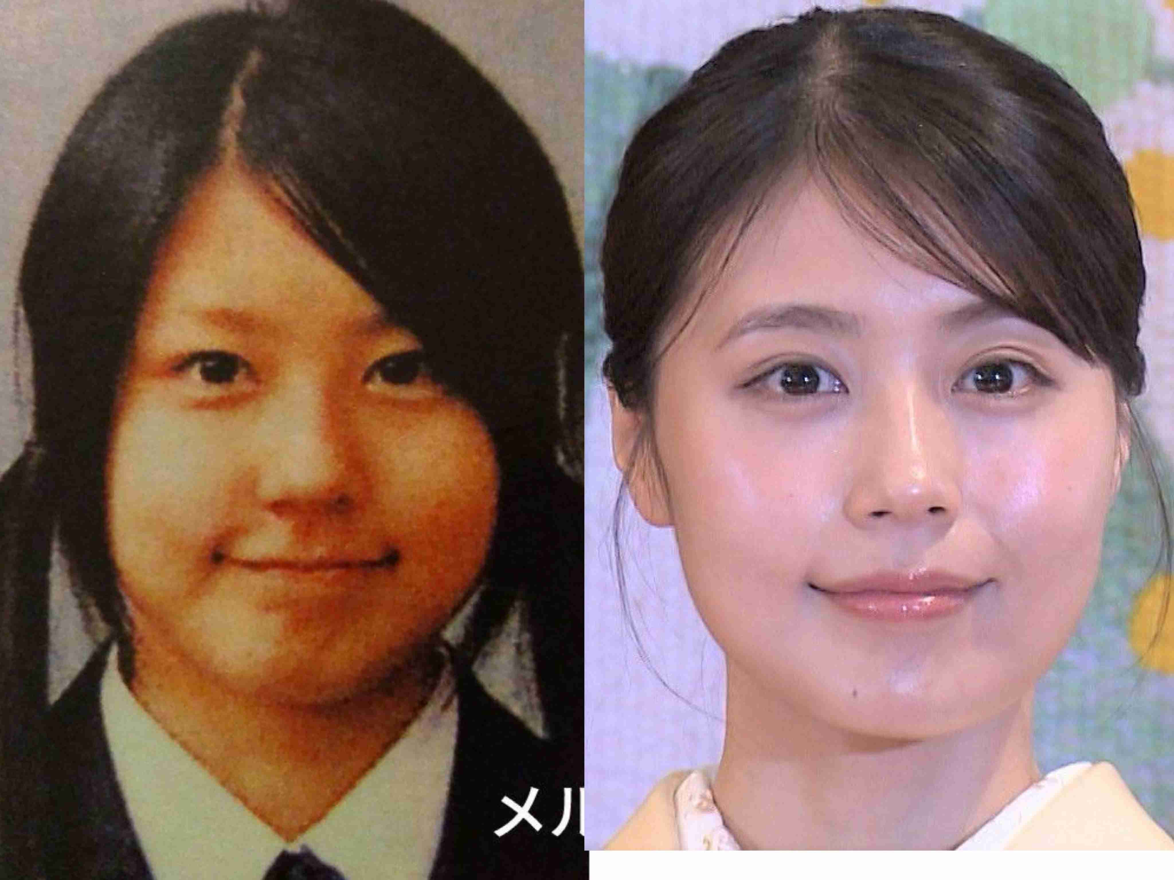 男ウケ顔を挙げてくトピPart2