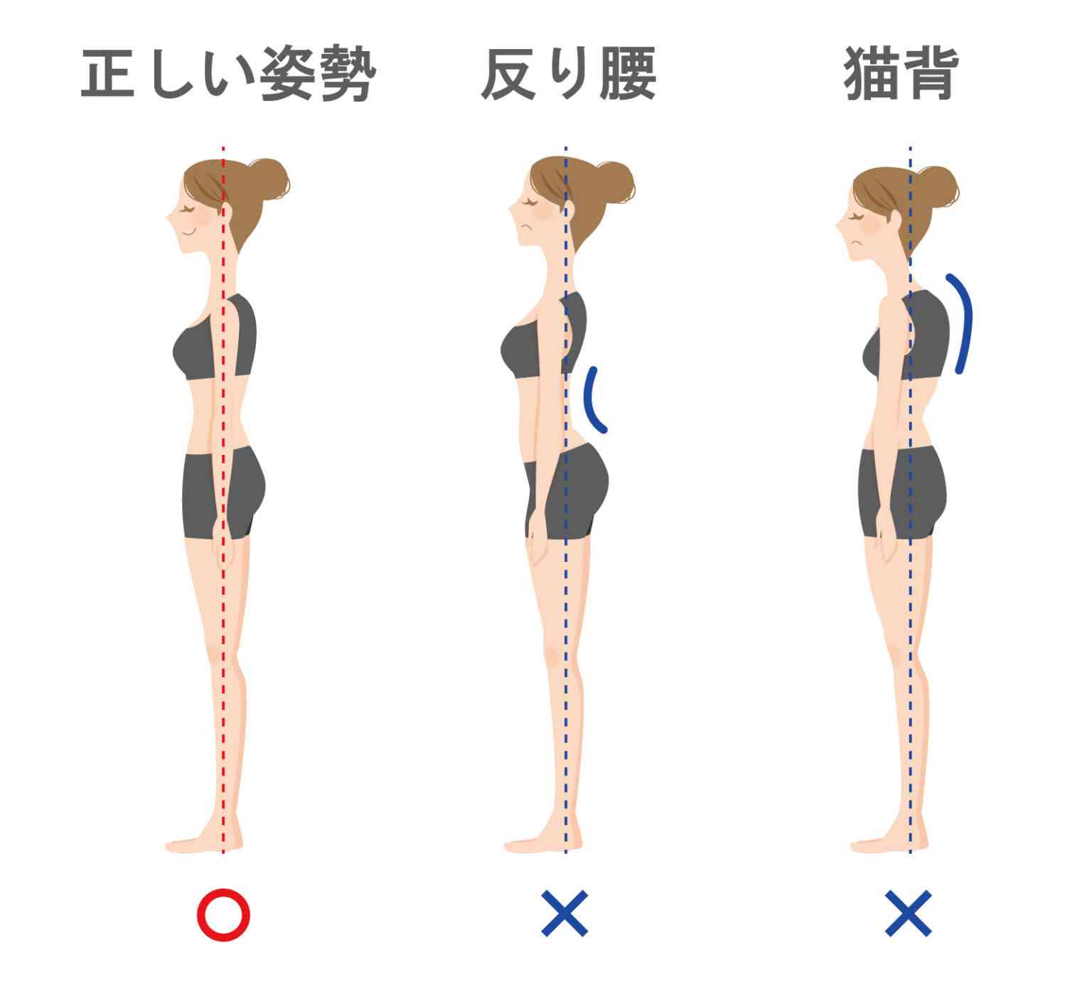 森香澄、ピーチ・ジョン新ミューズ就任　爽やか夏ランジェリー着こなす“アザーカット”公開