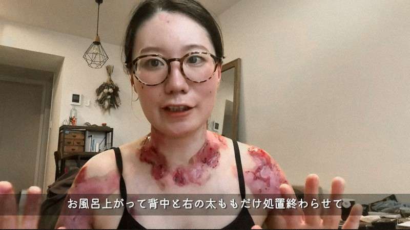 【持病】顔色の悪い人が元気そうに見える方法【地黒】