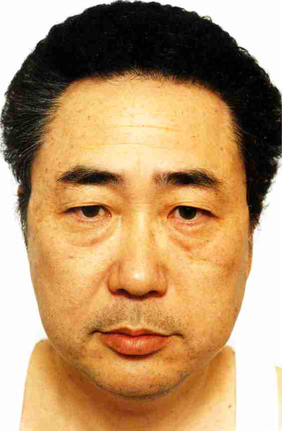高須克弥院長“癌の原因”人間ドックをやめたと衝撃告白「僕の癌はこれが原因と確信しています」