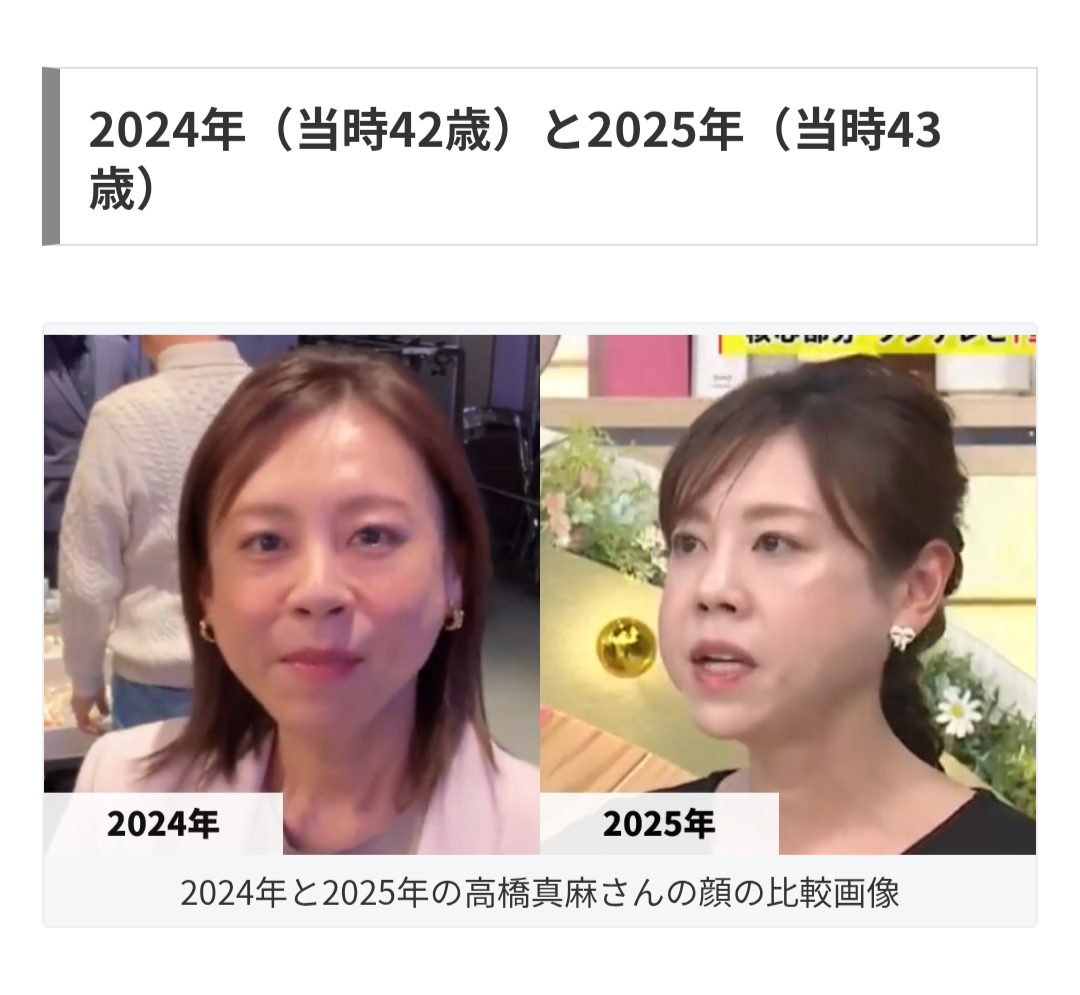 「聞いてるのがツラい」高橋真麻 生放送での“異変”に心配の声…近年は体調不安と闘う日々で“やつれ姿”も話題に