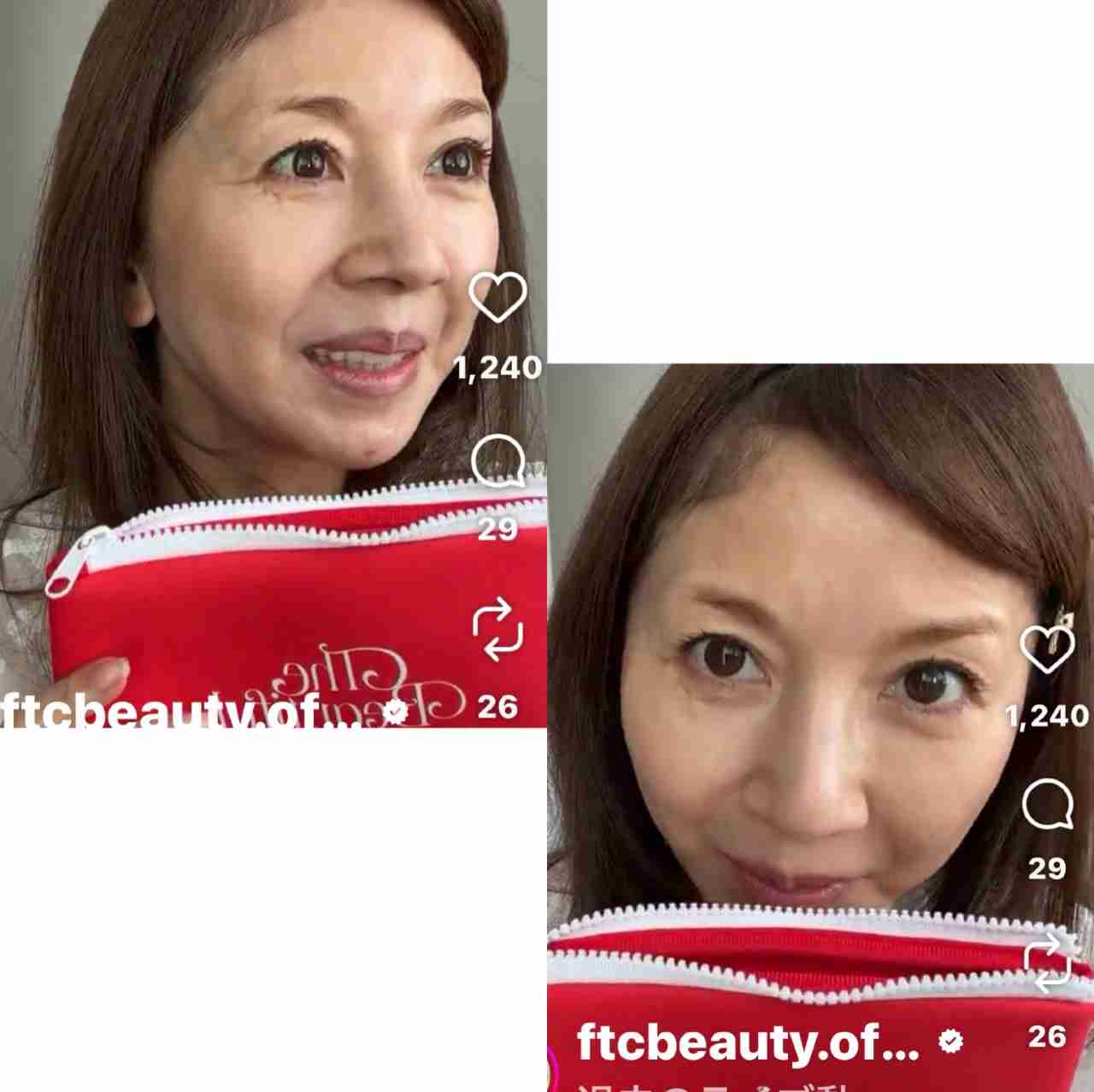 59歳・君島十和子、40代の頃“手抜きして後悔した”3つの美容習慣を明かす「私ほどやっていてもちゃんと老けます」