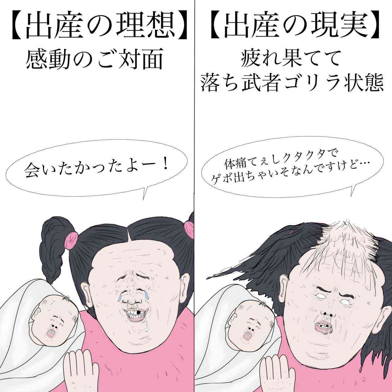 妊娠出産で歯がボロボロ