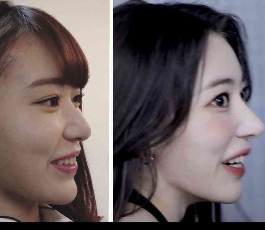 「HKT時代のさくらたんの方が…」宮脇咲良(28)の“激変”近影に旧ファンは複雑!?韓国での完璧なる進化に称賛と困惑の声