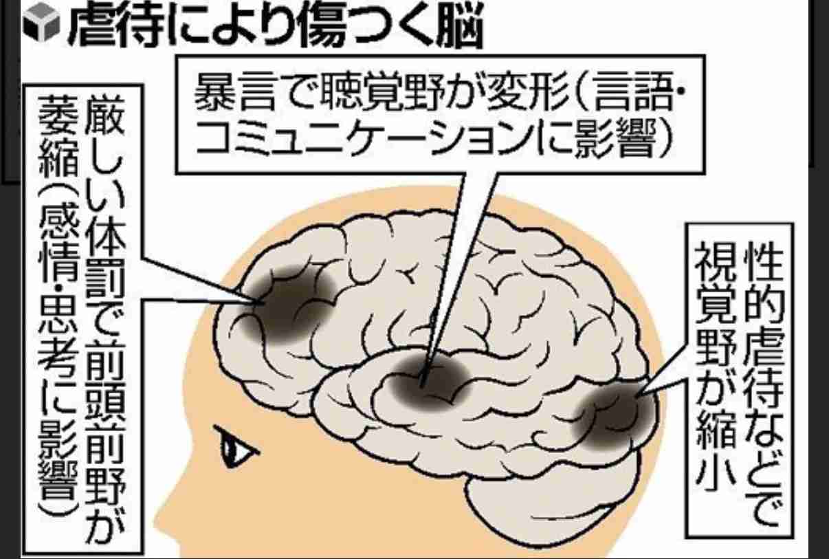 サバンナ高橋、生放送で自身めぐる騒動に言及 山里亮太「2人でしゃべったんですよね?じゃあ終わりじゃないですか?」
