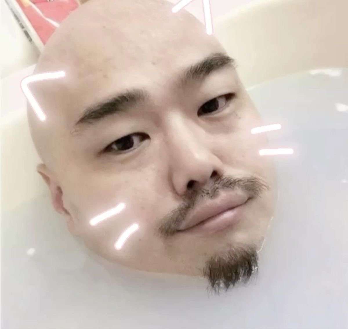 息子がハゲてきた！