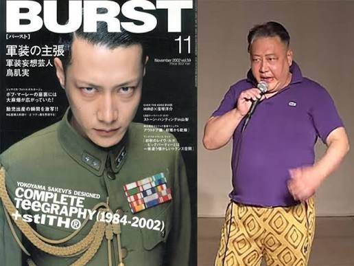 【整形】加齢によるたるみを取りたい
