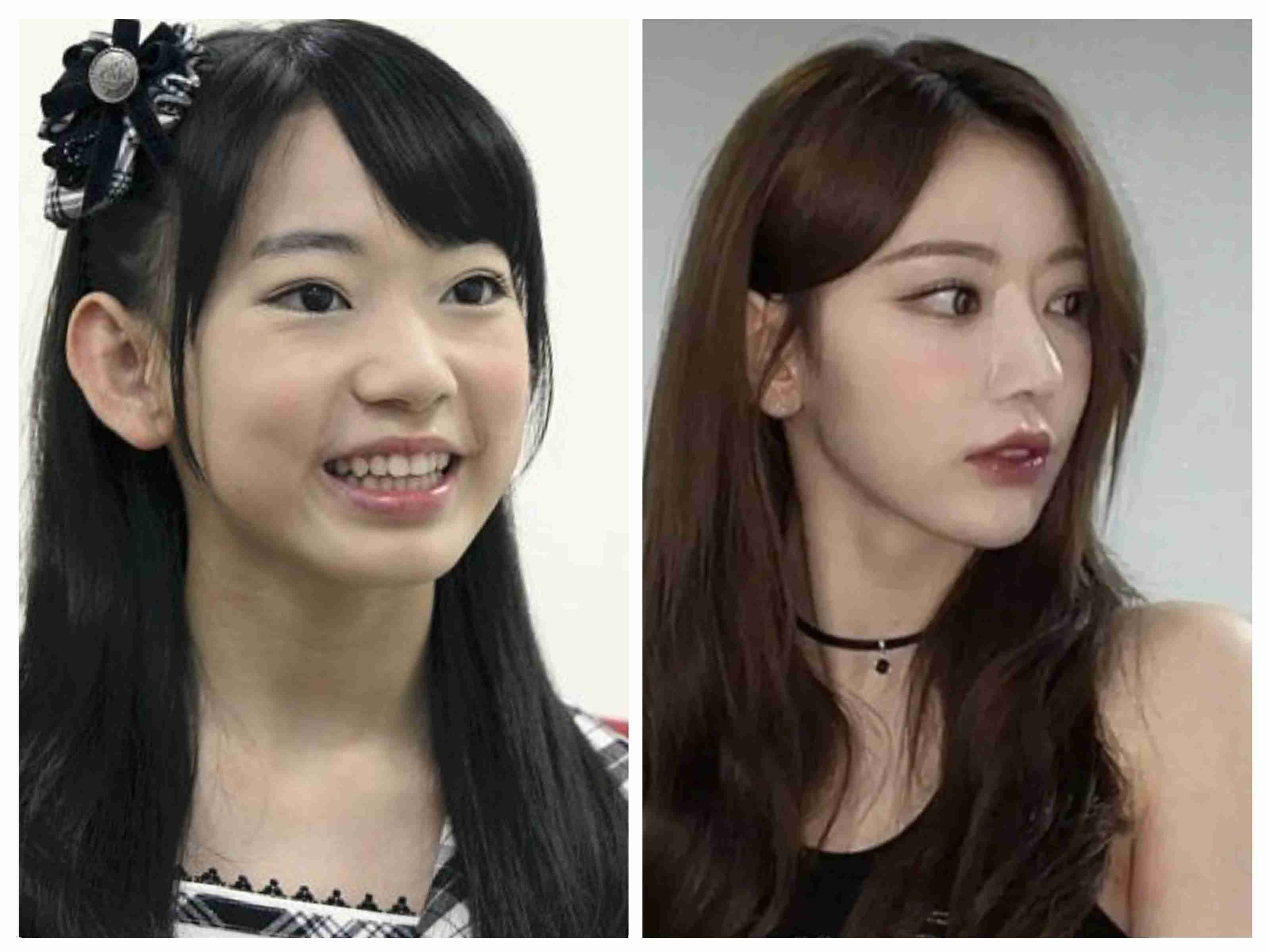【整形】加齢によるたるみを取りたい