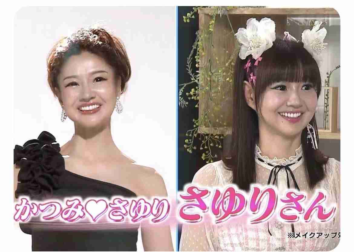 【整形】加齢によるたるみを取りたい
